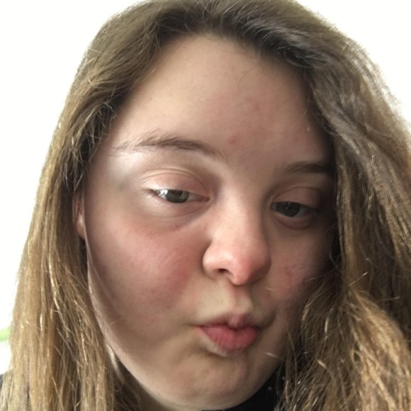 chloedretzka